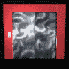 Anic0009.gif